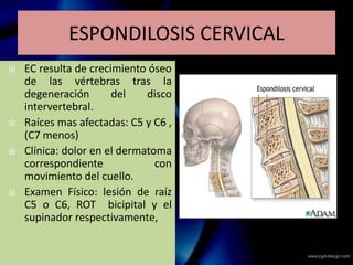 ESPONDILOSIS CERVICAL
 EC resulta de crecimiento óseo
de las vértebras tras la
degeneración del disco
intervertebral.
 Raíces mas afectadas: C5 y C6 ,
(C7 menos)
 Clínica: dolor en el dermatoma
correspondiente con
movimiento del cuello.
 Examen Físico: lesión de raíz
C5 o C6, ROT bicipital y el
supinador respectivamente,
 