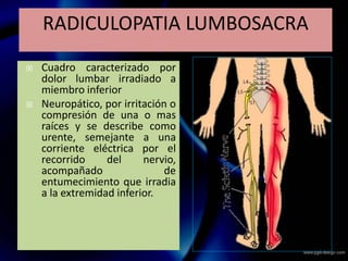  Cuadro caracterizado por
dolor lumbar irradiado a
miembro inferior
 Neuropático, por irritación o
compresión de una o mas
raíces y se describe como
urente, semejante a una
corriente eléctrica por el
recorrido del nervio,
acompañado de
entumecimiento que irradia
a la extremidad inferior.
RADICULOPATIA LUMBOSACRA
 