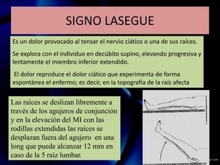 Es un dolor provocado al tensar el nervio ciático o una de sus raíces.
Se explora con el individuo en decúbito supino, elevando progresiva y
lentamente el miembro inferior extendido.
El dolor reproduce el dolor ciático que experimenta de forma
espontánea el enfermo; es decir, en la topografía de la raíz afecta.
Las raíces se deslizan libremente a
través de los agujeros de conjunción
y en la elevación del MI con las
rodillas extendidas las raíces se
desplazan fuera del agujero en una
long que puede alcanzar 12 mm en
caso de la 5 raíz lumbar.
SIGNO LASEGUE
 
