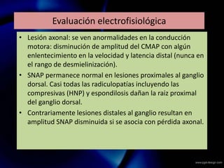 Evaluación electrofisiológica
• Lesión axonal: se ven anormalidades en la conducción
motora: disminución de amplitud del CMAP con algún
enlentecimiento en la velocidad y latencia distal (nunca en
el rango de desmielinización).
• SNAP permanece normal en lesiones proximales al ganglio
dorsal. Casi todas las radiculopatías incluyendo las
compresivas (HNP) y espondilosis dañan la raiz proximal
del ganglio dorsal.
• Contrariamente lesiones distales al ganglio resultan en
amplitud SNAP disminuida si se asocia con pérdida axonal.
 