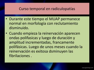 Curso temporal en radiculopatías
• Durante este tiempo el MUAP permanece
normal en morfología con reclutamiento
disminuido.
• Cuando empieza la reinervación aparecen
ondas polifasicas y luego de duración y
amplitud incrementadas, francamente
polifásicas. Luego de unos meses cuando la
reinervación es exitosa dsminuyen las
fibrilaciones .
 