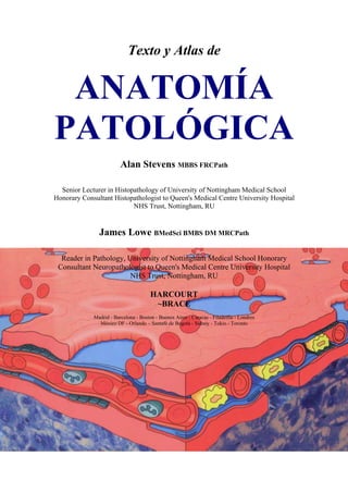 Texto y Atlas de


 ANATOMÍA
PATOLÓGICA
                         Alan Stevens MBBS FRCPath

  Senior Lecturer in Histopathology of University of Nottingham Medical School
Honorary Consultant Histopathologist to Queen's Medical Centre University Hospital
                           NHS Trust, Nottingham, RU


               James Lowe BMedSci BMBS DM MRCPath

  Reader in Pathology, University of Nottingham Medical School Honorary
 Consultant Neuropathologist to Queen's Medical Centre University Hospital
                        NHS Trust, Nottingham, RU

                                       HARCOURT
                                        ~BRACE
             Madrid - Barcelona - Boston - Buenos Aires - Caracas - Filadelfia - Londres
               México DF - Orlando – Santafé de Bogotá - Sidney - Tokio - Toronto
 