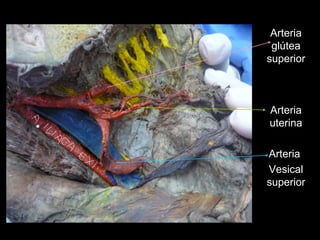 Arteria
 glútea
superior



Arteria
uterina

Arteria
Vesical
superior
 