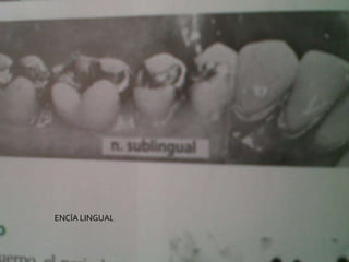 ENCÍA LINGUAL
 