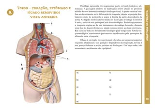 ANATOMIA
NA
PRÁTICA
19
O esôfago apresenta três segmentos: parte cervical, torácica e ab-
dominal. A passagem através do diafragma ocorre abaixo do processo
xifoide do osso esterno (constrição diafragmática). A parte torácica loca-
liza-se dorsalmente até a bifurcação da traqueia; depois se projeta dire-
tamente atrás do pericárdio e segue à direita da parte descendente da
aorta. Na região imediatamente acima do diafragma o esôfago é anterior
à aorta, antes de sua passagem pelo hiato esofágico. Embriologicamente
a traqueia origina-se de um brotamento do esôfago havendo, durante
uma fase do desenvolvimento, ampla conexão entre as duas estruturas.
Em casos de falha no fechamento fisiológico pode surgir uma fístula tra-
queoesofágica, ocasionando pneumonias recidivantes pela passagem do
alimento para a traqueia.
O baço é um órgão intraperitoneal e localiza-se na porção superior
esquerda abdominal e sua posição é dependente da respiração, devido à
sua posição inferior e muito próxima ao diafragma. Um baço sadio, não
aumentado, geralmente não é palpável.
Torso - coração, estômago e
fígado removidos
vista anterior
a)
b)
c)
d)
e)
f)
g)
h)
i)
9.
9. TORSO - CORAÇÃO, ESTÔMAGO E FÍGADO
REMOVIDOS - VISTA ANTERIOR
c
d
h
g
e
f
b
a
i
 