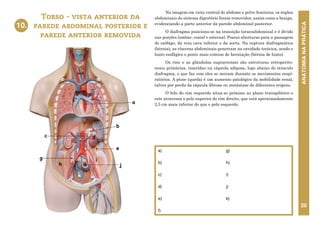 ANATOMIA
NA
PRÁTICA
20
Na imagem em vista ventral do abdome e pelve feminina, os órgãos
abdominais do sistema digestório foram removidos, assim como a bexiga,
evidenciando a parte anterior da parede abdominal posterior.
O diafragma posiciona-se na transição toracoabdominal e é divido
nas porções lombar, costal e esternal. Possui aberturas para a passagem
do esôfago, da veia cava inferior e da aorta. Na ruptura diafragmática
(hérnia), as vísceras abdominais penetram na cavidade torácica, sendo o
hiato esofágico o ponto mais comum de herniação (hérnia de hiato).
Os rins e as glândulas suprarrenais são estruturas retroperito-
neais primárias, inseridas na cápsula adiposa, logo abaixo do músculo
diafragma, o que faz com eles se movam durante os movimentos respi-
ratórios. A ptose (queda) é um aumento patológico da mobilidade renal,
talvez por perda da cápsula fibrosa ou metástase de diferentes origens.
O hilo do rim esquerdo situa-se próximo ao plano transpilórico e
este atravessa o polo superior do rim direito, que está aproximadamente
2,5 cm mais inferior do que o polo esquerdo.
Torso - vista anterior da
parede abdominal posterior e
parede anterior removida
a)
b)
c)
d)
e)
f)
g)
h)
i)
j)
k)
10.
a
d
f
g
h
i
e
j
k
c
b
10.TORSO - VISTA ANTERIOR DA PAREDE
ABDOMINAL POSTERIOR E PAREDE ANTERIOR
REMOVIDA
 