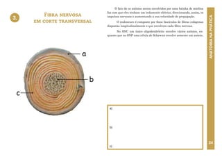 ANATOMIA
NA
PRÁTICA
24
O fato de os axônios serem envolvidos por uma bainha de mielina
faz com que eles tenham um isolamento elétrico, direcionando, assim, os
impulsos nervosos e aumentando a sua velocidade de propagação.
O endoneuro é composto por finos fascículos de fibras colágenas
dispostas longitudinalmente e que envolvem cada fibra nervosa.
No SNC um único oligodendrócito envolve vários axônios, en-
quanto que no SNP uma célula de Schawnn envolve somente um axônio.
Fibra nervosa
em corte transversal
a)
b)
c)
3.
3. FIBRA NERVOSA EM CORTE TRANSVERSAL
b
c
a
 