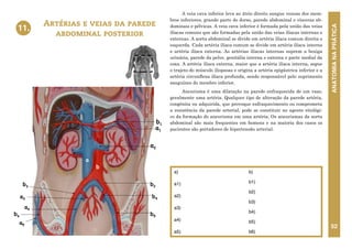 ANATOMIA
NA
PRÁTICA
52
A veia cava inferior leva ao átrio direito sangue venoso dos mem-
bros inferiores, grande parte do dorso, parede abdominal e vísceras ab-
dominais e pélvicas. A veia cava inferior é formada pela união das veias
ilíacas comuns que são formadas pela união das veias ilíacas internas e
externas. A aorta abdominal se divide em artéria ilíaca comum direita e
esquerda. Cada artéria ilíaca comum se divide em artéria ilíaca interna
e artéria ilíaca externa. As artérias ilíacas internas suprem a bexiga
urinária, parede da pelve, genitália interna e externa e parte medial da
coxa. A artéria ilíaca externa, maior que a artéria ilíaca interna, segue
o trajeto do músculo iliopsoas e origina a artéria epigástrica inferior e a
artéria circunflexa ilíaca profunda, sendo responsável pelo suprimento
sanguíneo do membro inferior.
Aneurisma é uma dilatação na parede enfraquecida de um vaso,
geralmente uma artéria. Qualquer tipo de alteração da parede artéria,
congênita ou adquirida, que provoque enfraquecimento ou comprometa
a resistência da parede arterial, pode se constituir no agente etiológi-
co da formação do aneurisma em uma artéria. Os aneurismas da aorta
abdominal são mais frequentes em homens e na maioria dos casos os
pacientes são portadores de hipertensão arterial.
Artérias e veias da parede
abdominal posterior
11.
a)
a1)
a2)
a3)
a4)
a5)
b)
b1)
b2)
b3)
b4)
b5)
b6)
a
b
b4
a3
b5
b2
b6
a5
b3
11. ARTÉRIAS E VEIAS DA PAREDE
ABDOMINAL POSTERIOR
a4
a1
a2
b1
a
b
b4
a3
b5
b2
b6
a5
b3
11. ARTÉRIAS E VEIAS DA PAREDE
ABDOMINAL POSTERIOR
a4
a1
a2
b1
 