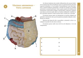 ANATOMIA
NA
PRÁTICA
67
As úlceras duodenais são erosões inflamatórias da mucosa duode-
nal. A maioria das úlceras duodenais ocorre na parede posterior da parte
superior do duodeno, a 3 cm do piloro. Ocasionalmente, uma úlcera per-
fura a parede duodenal, permitindo a entrada do conteúdo na cavidade
peritoneal e causando peritonite. Como a parte superior do duodeno está
intimamente relacionada ao fígado, vesícula biliar e pâncreas, qualquer
uma dessas estruturas pode aderir ao duodeno inflamado e também so-
frer ulceração enquanto a lesão continua para o tecido que a circunda.
O intestino grosso pode ser distinguido do intestino delgado por
apêndices omentais do colo, que são pequenas projeções adiposas, seme-
lhantes ao omento.
Existem três tênias do colo: a mesocólica, a omental e a livre e sa-
culações da parede do colo entre as tênias.
O intestino grosso mede cerca de 6,5 cm de diâmetro e 1,5 m de
comprimento.
4. VÍSCERAS ABDOMINAIS – VISTA ANTERIOR
b
d
c
g
f
h
e
a
i
Vísceras abdominais –
Vista anterior
4.
a)
b)
c)
d)
e)
f)
g)
h)
i)
 