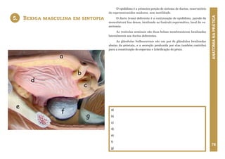 ANATOMIA
NA
PRÁTICA
78
O epidídimo é a primeira porção do sistema de ductos, reservatório
de espermatozoides maduros, sem motilidade.
O ducto (vaso) deferente é a continuação do epidídimo, parede da
musculatura lisa densa, localizado no funículo espermático, local da va-
sectomia.
As vesículas seminais são duas bolsas membranáceas localizadas
lateralmente aos ductos deferentes.
As glândulas bulbouretrais são um par de glândulas localizadas
abaixo da próstata, e a secreção produzida por elas também contribui
para a constituição do esperma e lubrificação do pênis.
Bexiga masculina em sintopia
5.
a)
b)
c)
d)
e)
f)
g)
5. BEXIGA MASCULINA EM SINTOPIA
c
b
f
e
d
a
g
 