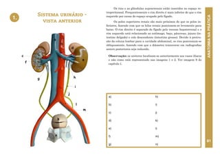 ANATOMIA
NA
PRÁTICA
81
a)
b)
c)
d)
e)
f)
g)
h)
i)
j)
k)
l)
m)
n)
Sistema urinário -
vista anterior
1.
Os rins e as glândulas suprarrenais estão inseridos no espaço re-
troperitoneal. Frequentemente o rim direito é mais inferior do que o rim
esquerdo por causa do espaço ocupado pelo fígado.
Os polos superiores renais são mais próximos do que os polos in-
feriores, fazendo com que os hilos renais posicionem-se levemente para
baixo. O rim direito é separado do fígado pelo recesso hepatorrenal e o
rim esquerdo está relacionado ao estômago, baço, pâncreas, jejuno (in-
testino delgado) e colo descendente (intestino grosso). Devido à protru-
são da coluna lombar para a cavidade abdominal, os rins posicionam-se
obliquamente, fazendo com que o diâmetro transverso em radiografias
antero posteriores seja reduzido.
Observação: os ureteres localizam-se anteriormente aos vasos ilíacos
e não como está representado nas imagens 1 e 2. Ver imagem 9 do
capítulo 1.
j
f
m
i
g
b
e
d
l
a
k
n
c
h
1. SISTEMA URINÁRIO – VISTA ANTERIOR
 