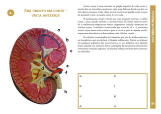 ANATOMIA
NA
PRÁTICA
84
A pelve renal é uma extensão na porção superior de cada ureter e
recebe dois ou três cálices maiores e cada uma deles se divide em dois ou
três cálices menores. Cada cálice menor recebe uma papila renal, o ápice
da pirâmide renal, no qual a urina é excretada.
O parênquima renal é divido em uma camada externa, o córtex
renal e uma camada interna, a medula renal. No córtex existem cerca
de 2,4 milhões de corpúsculos renais e segmentos iniciais e terminais de
túbulos renais. A medula é constituída por cerca de 10 a 12 pirâmides
renais, cujas bases estão voltadas para o córtex e para a cápsula renal e
segmentos ascendentes e descendentes dos túbulos renais.
Os cálculos renais podem ser formados por sais de ácidos orgânicos
ou inorgânicos que precipitam e formam sedimentos. Podem se originar
em qualquer segmento das vias urinárias ou nos próprios rins. Quando
ficam alojados nos ureteres, fortes contrações da musculatura lisa destas
estruturas tentando expulsar os cálculos podem provocar dores intensas
no indivíduo.
Rim direito em corte -
vista anterior
4.
a)
b)
c)
d)
e)
f)
g)
h)
4. RIM DIREITO EM CORTE –
VISTA ANTERIOR
b
a
e
c
h
g
d
f
 