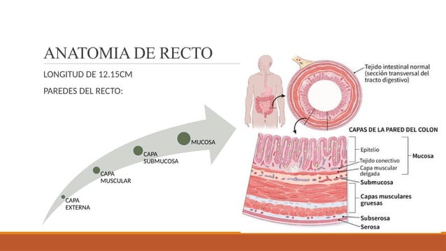 ANATOMIA QUIRURGICA DE ANO Y RECTO Y PATOLOGIA BENIGNA.pptx