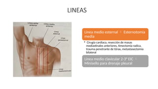 LINEAS
Línea medio esternal  Esternotomía
media
• Cirugía cardiaca, resección de masas
mediastinales anteriores, timectomía radica,
trauma penetrante de tórax, metastasectomía
bilateral
Línea medio clavicular 2-3° EIC 
Minisello para drenaje pleural
 