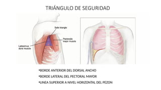 TRIANGULODESEGURIDAD
LIMITESANATOMICOS
•BORDE ANTERIOR DEL DORSAL ANCHO
•BORDE LATERAL DEL PECTORAL MAYOR
•LINEA SUPERIOR A NIVEL HORIZONTAL DEL PEZON
TRIÁNGULO DE SEGURIDAD
 