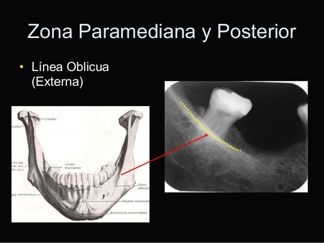 Anatomia radiográfica maxilar y mandíbula uss rx
