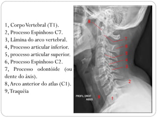 1, Corpo Vertebral (T1). 2, Processo Espinhoso C7. 3, Lâmina do arco vertebral. 4, Processo articular inferior. 5, processo articular superior. 6, Processo Espinhoso C2. 7, Processo odontóide (ou dente do áxis). 8, Arco anterior do atlas (C1). 9, Traquéia  