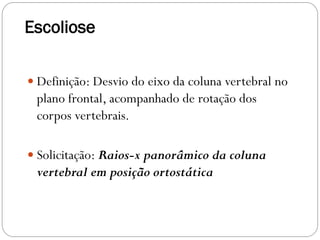 Escoliose 
Definição: Desvio do eixo da coluna vertebral no plano frontal, acompanhado de rotação dos corpos vertebrais. 
Solicitação: Raios-x panorâmico da coluna vertebral em posição ortostática  