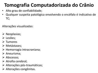 Tomografia Computadorizada do Crânio
• Alto grau de confiabilidade;
• Qualquer suspeita patológica envolvendo o encéfalo é indicativo de
  TC;

Alterações visualizadas:

   Neoplasias;
   Lesões;
   Tumores
   Metástases;
   Hemorragia intracraniana;
   Aneurisma;
   Abscesso;
   Atrofia cerebral;
   Alterações pós-traumáticas;
   Alterações congênitas.
 