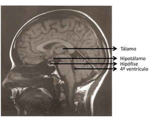 Tálamo
Hipotálamo
Hipófise
4º ventrículo
 