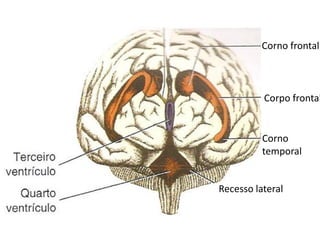 Corno frontal



          Corpo frontal


          Corno
          temporal


Recesso lateral
 