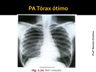 ProfªRenataCristina
 