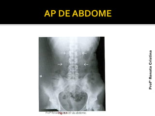 Profª Renata Cristina
ProfªRenataCristina
 