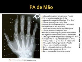 A.Articulação carpo metacarpiana do 1º dedo
B.Primeiro metacarpo da mão direita
C.Articulaçãometacarpo falangiana do 1º dedo
D.Falange proximal do primeiro dedo
E.Articulação interfalangiana do primeiro dedo
F.Falange distal do primeiro dedo
G.Segunda articulação metacarpo falangiana
H.Falange proximal do segundo dedo
I.Articulação interfalangiana proximal do 2º dedo
J.Falange média do segundo dedo da mão direita
K.Articulação interfalangiana distal do segundo dedo
L.Falange distal do segundo dedo da mão direita
M.Falange média do quarto dedo da mão direita
N.Articulação interfalangiana distal 5º dedo
O.Falange proximal do terceiro dedo
P.Quinta articulação metacarpo falangiana
Q.Quarto metacarpo da mão direita
R.Quinta articulaçãocarpo metacarpiana
Profª Renata Cristina
ProfªRenataCristina
 