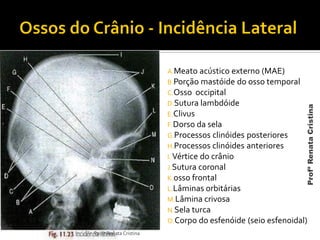 A.Meato acústico externo (MAE)
B.Porção mastóide do osso temporal
C.Osso occipital
D.Sutura lambdóide
E.Clivus
F.Dorso da sela
G.Processos clinóides posteriores
H.Processos clinóides anteriores
I. Vértice do crânio
J.Sutura coronal
K.osso frontal
L.Lâminas orbitárias
M.Lâmina crivosa
N.Sela turca
O.Corpo do esfenóide (seio esfenoidal)
Profª Renata Cristina
ProfªRenataCristina
 