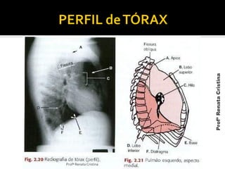 Profª Renata Cristina
ProfªRenataCristina
 