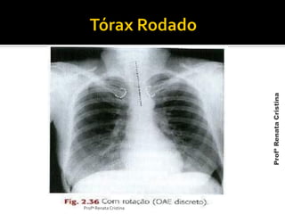 Profª Renata Cristina
ProfªRenataCristina
 