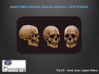 ANATOMÍA RADIOLÓGICA CRANEO -VERTEBRAL
T.S.I.D - José Juan López Valera
 