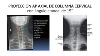 ANATOMIA RADIOLOGICA DE COLUMNA VERTEBRAL NEW.pptx