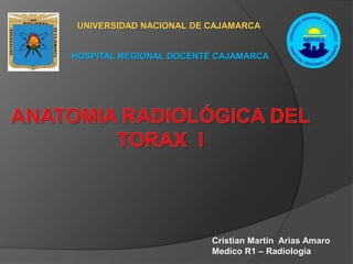 UNIVERSIDAD NACIONAL DE CAJAMARCA
HOSPITAL REGIONAL DOCENTE CAJAMARCA
Cristian Martin Arias Amaro
Medico R1 – Radiologia
 