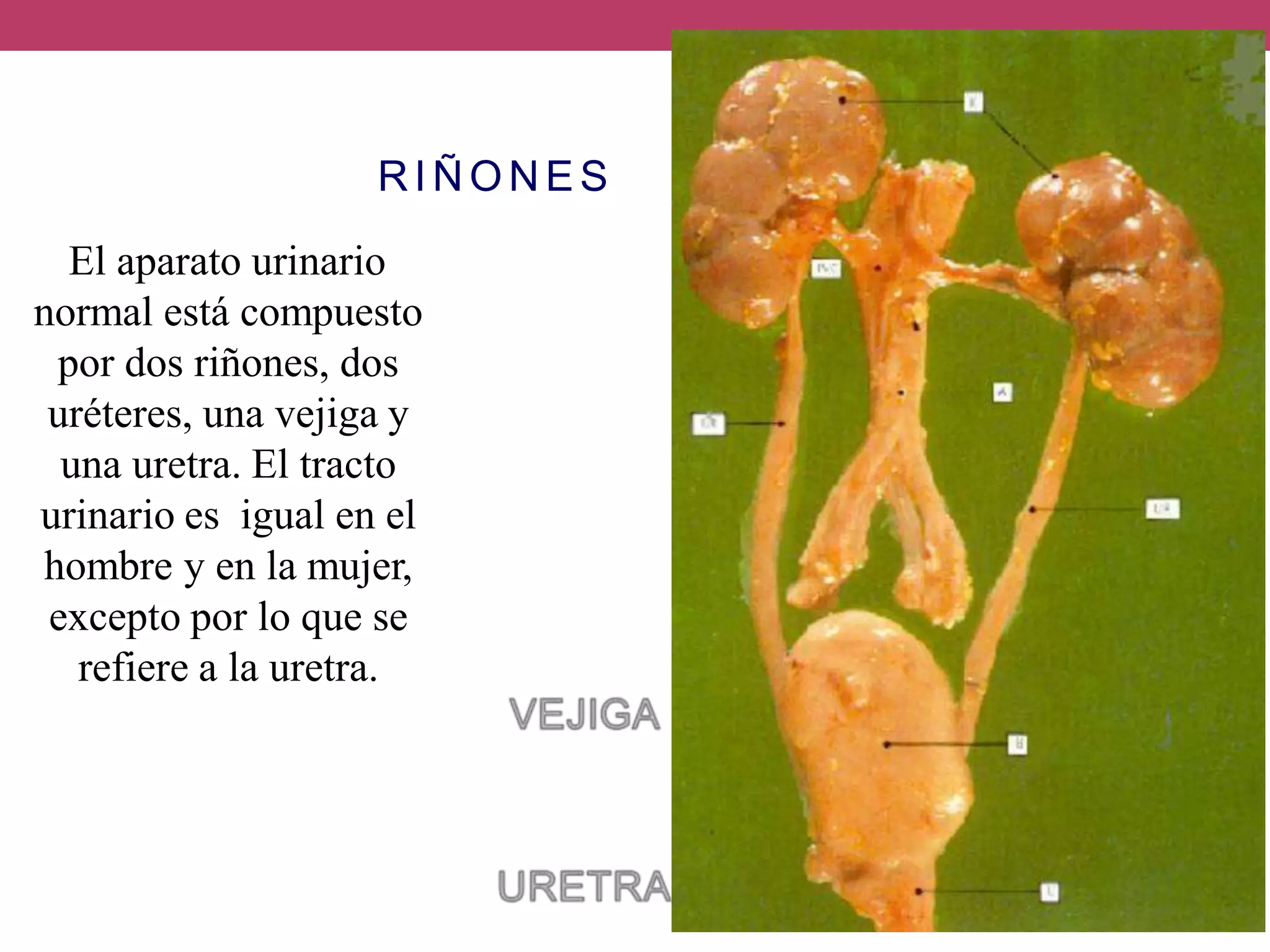 Anatomia Renal.pptx