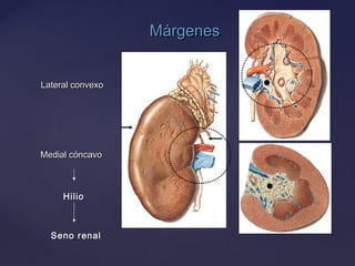 MárgenesMárgenes
Lateral convexoLateral convexo
Medial cóncavoMedial cóncavo
HilioHilio
Seno renalSeno renal
 