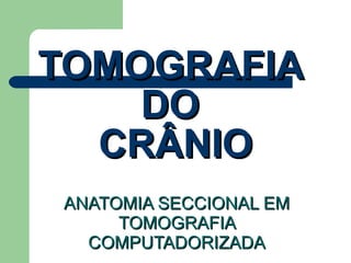 TOMOGRAFIA  DO  CRÂNIO ANATOMIA SECCIONAL EM TOMOGRAFIA COMPUTADORIZADA 