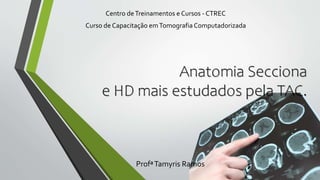 Anatomia Secciona
e HD mais estudados pela TAC.
ProfªTamyris Ramos
Centro deTreinamentos e Cursos - CTREC
Curso de Capacitação emTomografia Computadorizada
 