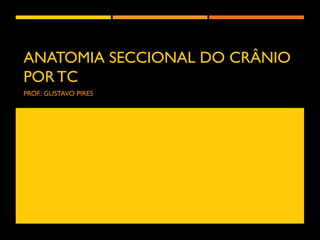 ANATOMIA SECCIONAL DO CRÂNIO
POR TC
PROF.: GUSTAVO PIRES
 