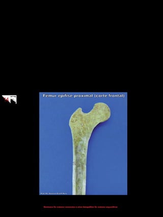 1414
Anatomia do sistema locomotor e atlas fotográfico do sistema esquelético
Periósteo: é uma lâmina fina de tecido conjuntivo denso que recobre qua-
se toda a superfície externa de um osso. Contendo diversas células formadoras de
osso que participam ativamente do crescimento (em largura) e da reparação ós-
sea, o periósteo também protege o osso, serve como ponto de fixação para tendões
e ligamentos e fornece uma via de condução para os suprimentos circulatório e
nervoso.
Endósteo: é uma membrana fina de tecido conjuntivo especializado, com
capacidade de formação e reparo ósseo, que reveste a cavidade medular.
Cartilagem articular: é uma camada de cartilagem hialina que recobre o
local onde os ossos se articulam nas estruturas adjacentes.
Medula óssea: é a substância contida no interior dos ossos. Quando apre-
senta predomínio de tecido adiposo, é classificada como medula óssea amarela,
localizada no interior do canal medular dos ossos longos. O outro tipo de medula
óssea encontrada é a medula óssea vermelha, que apresenta a capacidade de
formar as células sanguíneas; um processo chamado de “hematopoese”. Esse tipo
de medula está presente nos ossos em desenvolvimento de um feto e, no adulto,
localiza-se junto da substância óssea esponjosa.
1 - Osso esponjoso 2 - Osso compacto 3 - Canal medular
 