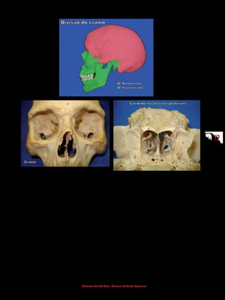 1717
Gustavo Graeff Kura, Marcos Roberto Spassim
1 - Nasal
2 - Vômer
3 - Lâmina perpendicular do etmoide
4 - Septo nasal
5 - Concha nasal inferior
6 - Fissura orbital superior
7 - Fissura orbital inferior
8 - Frontal
9 - Zigomático
10 - Esfenoide
11 - Margem supraorbital
12 - Margem infraorbital
13 - Forame infraorbital
14 - Maxilar
1 - Concha nasal inferior
2 - Concha nasal média
3 - Palatino
4 - Maxilar
5 - Vômer
6 - Septo nasal
7 - Parede lateral da cavidade nasal
8 - Processo pterigoide do esfenoide
 
