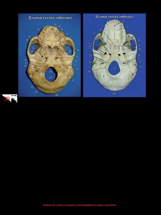 2020
Anatomia do sistema locomotor e atlas fotográfico do sistema esquelético
1 - Occipital
2 - Temporal
3 - Esfenoide
4 - Maxila
5 - Zigomático
6 - Vômer
7 - Palatino
8 - Arco zigomático
9 - Processo mastoide
10 - Protuberância
occipital externa
11 - Processo estiloide
12 - Processo terigoide
do osso esfenoide
13 - Forame magno
14 - Côndilos do occipital
15 - Fossa incisiva
16 - Processo palatino da maxila
17 - Lâmina horizontal do
palatino
18 - Fossa mandibular
19 - Forame oval
20 - Forame espinhoso
21 - Forame lacerado
22 - Canal carótico
23 - Forame jugular
24 - Forame estilomastoideo
25 - Forame palatino maior
26 - Forame palatino menor
27 - Processo alveolar
28 - Linha nucal superior
29 - Linha nucal inferior
1 - Occipital
2 - Temporal
3 - Esfenoide
4 - Maxila
5 - Zigomático
6 - Vômer
7 - Palatino
8 - Arco zigomático
9 - Processo mastoide
10 - Protuberância occipital
externa
11 - Processo estiloide
12 - Processo pterigoide do
osso esfenoide
 