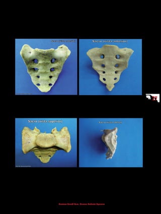 2727
Gustavo Graeff Kura, Marcos Roberto Spassim
4.2.5 Sacro e cóccix
O sacro e o cóccix são ossos formados pela fusão das vértebras sacrais e
coccígeas respectivamente. A coluna vertebral articula-se com os ossos do quadril
através das faces auriculares do sacro.
18 - Asa do sacro
22 - Forame sacral anterior
25 - Promontório
18 - Asa do sacro
22 - Forame sacral anterior
25 - Promontório
27 - Cóccix
7 - Face articular lombossacral
18 - Asa do sacro
22 - Forame sacral anterior
24 - Processo articular superior
25 - Promontório
26 - Face articular para o osso do quadril
(face auricular)
	
 