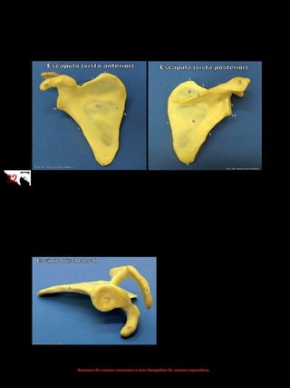 3232
Anatomia do sistema locomotor e atlas fotográfico do sistema esquelético
5.1.2 Escápula
Osso plano, de formato triangular, localizado na parede posterior do tórax
(dorso).
2 - Acrômio
5 - Margem superior da escápula
6 - Margem medial da escápula
7 - Margem lateral da escápula
8 - Ângulo superior da escápula
9 - Ângulo inferior da escápula
10 - Tubérculo infraglenoidal
11 - Fossa subescapular
12 - Incisura da escápula
13 - Processo coracoide
1 - Espinha da escápula
2 - Acrômio
3 - Fossa supraespinhal
4 - Fossa infraespinhal
5 - Margem superior da escápula
6 - Margem medial da escápula
7 - Margem lateral da escápula
8 - Ângulo superior da escápula
9 - Ângulo inferior da escápula
10 - Tubérculo infraglenoidal
14 - Cavidade glenoide
2 - Acrômio
7 - Margem lateral da escápula
10 - Tubérculo infraglenoidal
13 - Processo coracoide
14 - Cavidade glenoide
15 - Tubérculo supraglenoidal
 