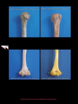 3434
Anatomia do sistema locomotor e atlas fotográfico do sistema esquelético
1 - Cabeça
3 - Tubérculo maior
5 - Colo anatômico
6 - Colo cirúrgico
1 - Cabeça
2 - Tubérculo menor
3 - Tubérculo maior
4 - Sulco intertubercular
5 - Colo anatômico
6 - Colo cirúrgico
9 - Capítulo
10 - Tróclea
11 - Epicôndilo medial
12 - Epicôndilo lateral
13 - Fossa coronoide
14 - Fossa radial
10 - Tróclea
11 - Epicôndilo medial
12 - Epicôndilo lateral
13 - Fossa coronoide
16 - Fossa do olécrano
 