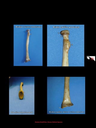 3535
Gustavo Graeff Kura, Marcos Roberto Spassim
5.1.4 Rádio e ulna
São ossos situados no antebraço. O rádio localiza-se lateralmente e a ulna,
medialmente. Ambos estão conectados através das articulações radioulnar proxi-
mal e distal. Proximalmente, articulam-se com o úmero no cotovelo e, distalmen-
te, com os ossos do carpo no punho.
1 - Cabeça do rádio
2 - Colo
4 - Tuberosidade do rádio
6 - Processo estiloide
1 - Cabeça do rádio
2 - Colo
4 - Tuberosidade do rádio
3 - Fóvea da cabeça do rádio
4 - Tuberosidade do rádio
6 - Processo estiloide
 