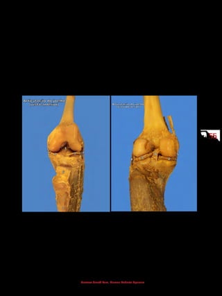 5555
Gustavo Graeff Kura, Marcos Roberto Spassim
Eversão: elevação da borda lateral do pé.
Inversão: elevação da borda medial do pé.
Oposição: movimento da polpa (ponta) do polegar (primeiro dedo) em dire-
ção à polpa dos demais dedos da mão.
Reposição: movimento de retorno do polegar à posição anatômica.
Flexão lateral: movimento de inclinação da coluna vertebral lateralmen-
te.
Flexão plantar: movimento em que o dorso do pé é afastado da face ante-
rior da perna (ficar na ponta dos dedos dos pés).
Dorsiflexão: movimento em que o dorso do pé é aproximado da face ante-
rior da perna.
 