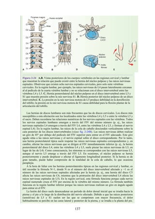 Figura 2-24 A,B. Vistas posteriores de los cuerpos vertebrales en las regiones cervical y lumbar
que muestran la relación que puede existir entre la hernia del núcleo pulposo y las raíces nerviosas
espinales. Obsérvese que existen ocho nervios espinales cervicales, pero solo siete vértebras
cervicales. En la región lumbar, por ejemplo, las raíces nerviosas de L4 pasan lateralmente cercanas
al al pedículo de la cuarta vértebra lumbar y no se relacionan con el disco intervertebral entre las
vértebras L4 y L5. C. Hernia posterolateral del núcleo pulposo en el disco intervertebral entre L5 y
S1 que muestra presión sobre la raíz nerviosa S1. D. Hernia posterior del núcleo pulposo de un disco
intervertebral. E. La presión en la raíz nerviosa motora de L5 produce debilidad en la dorsiflexión
del tobillo; la presión en la raíz nerviosa motora de S1 causa debilidad para la flexión plantar de la
articulación del tobillo.
Las hernias de discos lumbares son más frecuentes que las de discos cervicales. Los discos más
susceptibles a esta afectación son los localizados entre las vértebras L4 y L5 o entre la vértebra L5 y
el sacro. Deben recordarse las relaciones numéricas de los nervios espinales con las vértebras. Todos
los nervios espinales lumbares emergen a través del FIV del mismo número (p. ej., las raíces
nerviosas espinales L4 emergen a través del FIV L4, entre las vértebras L4 y L5, y forman el nervio
espinal L4). En la región lumbar, las raíces de la cola de caballo descienden verticalmente sobre la
cara posterior de los discos intervertebrales (véase fig. 2-24B). Las raíces nerviosas deben realizar
un giro de 45° por debajo del pedículo del FIV superior para entrar en el FIV adecuado. Este giro
agudo sitúa a las raíces nerviosas y el nervio espinal sobre el disco correspondiente. Por lo tanto,
una hernia posterolateral típica suele respetar las raíces nerviosas espinales correspondientes y, en
cambio, afectar las raíces nerviosas que se dirigen al FIV inmediatamente inferior (p. ej., la hernia
posterolateral del disco L4, entre las vértebras L4 y L5, suele pinzar las raíces nerviosas de L5, en
lugar de las de L4). Como consecuencia, los síntomas se corresponden con las raíces nerviosas L5,
aunque el nervio L5 emerge a través del FIV L5. En ocasiones, el núcleo pulposo se hernia
posteriormente y puede desplazar o afectar el ligamento longitudinal posterior. Si la hernia es de
gran tamaño, puede haber compresión de la totalidad de la cola de caballo, lo que ocasiona
paraplejia.
A la hora de lidiar con las hernias posterolaterales típicas en las regiones cervical y lumbar, es
útil recordar la fórmula N+1, donde N es el número del disco intervertebral afectado y +1 es el
número de las raíces nerviosas espinales afectadas por la hernia (p. ej., una hernia del disco C5
afecta las raíces nerviosas de C6, mientras que la protrusión del disco intervertebral L4 afecta las
raíces nerviosas espinales de L5). En la región cervical, esta fórmula funciona porque cada nervio
espinal numerado cruza el FIV por encima de la vértebra del mismo número. La fórmula también
funciona en la región lumbar inferior porque las raíces nerviosas realizan un giro en ángulo agudo
para entrar en el FIV.
La lesión del disco suele desencadenar un período de dolor dorsal inicial que se irradia hacia la
pierna y el pie a lo largo de la distribución del nervio afectado. Debido a que las raíces posteriores
(sensitivas) de L5 y S1 suelen ser las que se comprimen con mayor frecuencia, el dolor
habitualmente se percibe en las caras lateral y posterior de la pierna, y se irradia a la planta del pie.
137
 