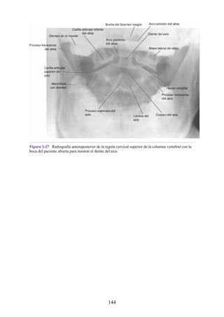 Figura 2-27 Radiografía anteroposterior de la región cervical superior de la columna vertebral con la
boca del paciente abierta para mostrar el diente del axis.
144
 