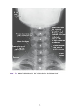 Figura 2-28 Radiografía anteroposterior de la región cervical de la columna vertebral.
145
 